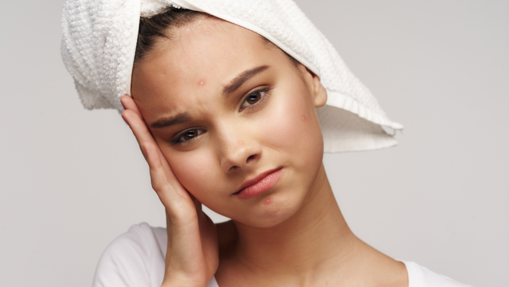 l'acné peut être source de complexes à l'adolescence